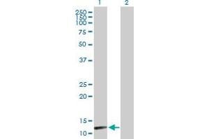 Western Blot analysis of NUDT8 expression in transfected 293T cell line by NUDT8 MaxPab polyclonal antibody. (NUDT8 antibody  (AA 1-140))