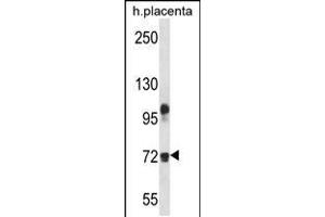 Western blot analysis in human placenta tissue lysates (35ug/lane). (Fibulin 1 antibody  (C-Term))