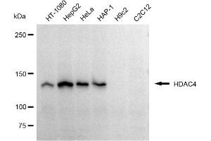 Western blotting analysis using HDAC4 antibody (ABIN7798933). (Recombinant HDAC4 antibody)