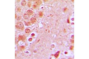Immunohistochemical analysis of SCC-S2 staining in human brain formalin fixed paraffin embedded tissue section. (TNFAIP8 antibody  (Center))