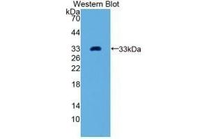 Detection of Recombinant GDF11, Human using Monoclonal Antibody to Growth Differentiation Factor 11 (GDF11) (GDF11 antibody  (AA 138-386))