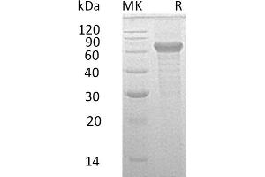IL20RB Protein (Fc Tag)