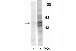 Western blot of recombinant tryptophan hydroxylase incubated in the absence (-) and presence (+) of cAMP-dependent protein kinase  showing specific immunolabeling of the ~55 kDa tryptophan hydroxylase protein phosphorylated at Ser58. (Tryptophan Hydroxylase 1 antibody  (pSer58))