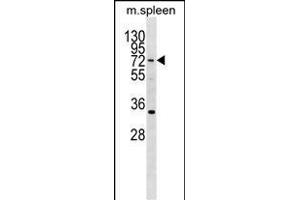 HIC2 Antibody (Center) (ABIN1538292 and ABIN2850037) western blot analysis in mouse spleen tissue lysates (35 μg/lane). (HIC2 antibody  (AA 311-338))