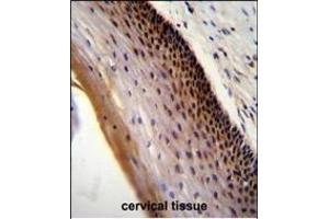 CCDC102A Antibody (C-term) (ABIN655241 and ABIN2844844) immunohistochemistry analysis in formalin fixed and paraffin embedded human cervical tissue followed by peroxidase conjugation of the secondary antibody and DAB staining. (CCDC102A antibody  (C-Term))