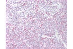 Anti-MCM3 antibody IHC of human thymus. (MCM3 antibody  (AA 726-775))