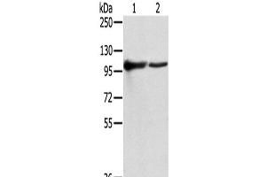Western Blot analysis of K562 and A431 cells using TPX2 Polyclonal Antibody at dilution of 1/800 (TPX2 antibody)