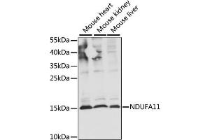 Western blot analysis of extracts of various cell lines, using NDUF antibody (ABIN7268798) at 1:1000 dilution. (NDUFA11 antibody  (AA 1-100))