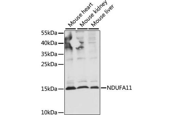 NDUFA11 Antikörper  (AA 1-100)