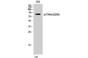 Western Blotting (WB) image for anti-P21-Activated Kinase 1 (PAK1) (pSer204) antibody (ABIN3182674) (PAK1 antibody  (pSer204))