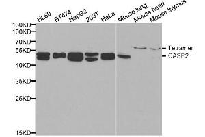 Western blot analysis of extracts of various cell lines, using CASP2 antibody.