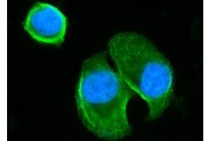 IF analysis of BLNK using anti-BLNK antibody (ABIN7602100).