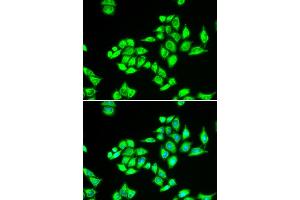 Immunofluorescence analysis of U2OS cells using TPD52L1 antibody (ABIN5973820). (TPD52L1 antibody)
