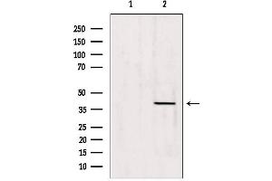 Western blot analysis of extracts from 293, using Caper Antibody. (ATP6AP2 antibody  (Internal Region))