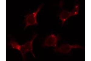 ABIN6279098 staining LOVO by IF/ICC. (AGXT2 antibody  (Internal Region))