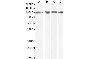 Western Blotting (WB) image for anti-Heat Shock Protein 90kDa beta (Grp94), Member 1 (HSP90B1) (Internal Region) antibody (ABIN185655)