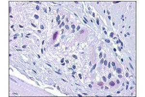 Human Colon, Myenteric Plexus: Formalin-Fixed, Paraffin-Embedded (FFPE) (Retinoblastoma Binding Protein 8 antibody)