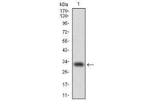 Image no. 1 for anti-CCAAT/enhancer Binding Protein (C/EBP), alpha (CEBPA) antibody (ABIN1497468)