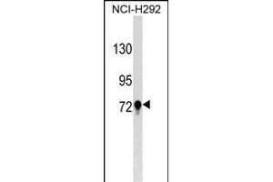 TGM3 Antibody (C-term) (ABIN1537448 and ABIN2849136) western blot analysis in NCI- cell line lysates (35 μg/lane). (TGM3 antibody  (C-Term))