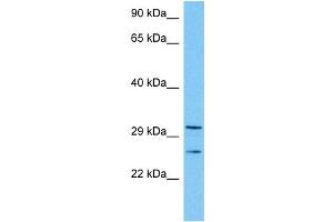 Host:  Mouse  Target Name:  TAL1  Sample Tissue:  Mouse Kidney  Antibody Dilution:  1ug/ml (TAL1 antibody  (Middle Region))