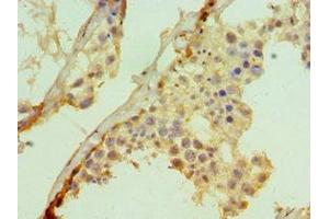 Immunohistochemistry of paraffin-embedded human testis tissue using ABIN7171013 at dilution of 1:100 (SUFUH antibody  (AA 325-484))