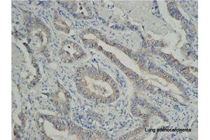 Immunohistochemistry (IHC) image for anti-Tumor Necrosis Factor Receptor Superfamily, Member 6b, Decoy (TNFRSF6B) antibody (ABIN2664922) (TNFRSF6B antibody)
