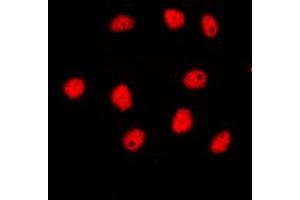 Immunofluorescent analysis of GATA4 staining in HepG2 cells. (GATA4 antibody  (Center))