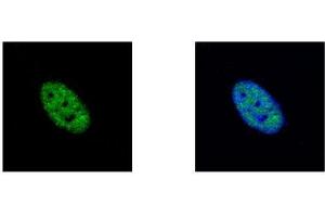 ICC/IF Image NEK4 antibody [N2C1], Internal detects NEK4 protein at nucleus by confocal immunofluorescent analysis. (NEK4 antibody)
