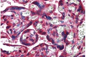 Human Placenta: Formalin-Fixed, Paraffin-Embedded (FFPE) (NDRG1 antibody  (AA 1-395))