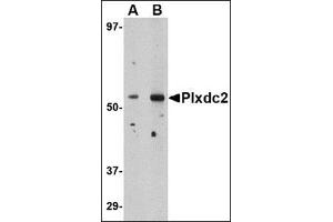 Western blot analysis of Plxdc2 in human brain tissue lysate with this product at (A) 0.