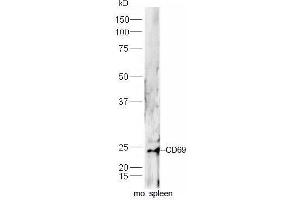 CD69 anticorps  (AA 101-199)