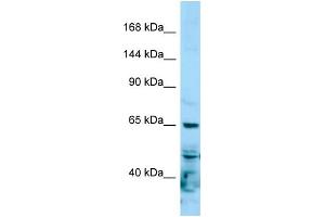 Western Blotting (WB) image for anti-RNA Polymerase II Subunit RPB1 (POLR2A) (N-Term) antibody (ABIN2788998) (POLR2A/RPB1 antibody  (N-Term))