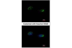 ICC/IF Image Immunofluorescence analysis of methanol-fixed HeLa, using Homer, antibody at 1:500 dilution. (HOMER1 antibody  (Center))