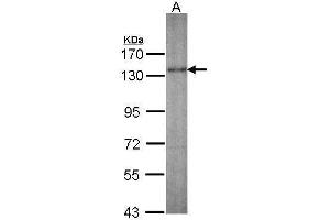 WB Image Sample (30 ug of whole cell lysate) A: IMR32 7. (KIF5A antibody  (C-Term))