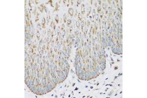 Immunohistochemistry of paraffin-embedded human esophagus using IGF2BP3 antibody (ABIN5972501) at dilution of 1/200 (40x lens). (IGF2BP3 antibody)