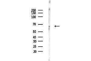 anti-Malic Enzyme 1, NADP(+)-Dependent, Cytosolic (ME1) (C-Term) antibody