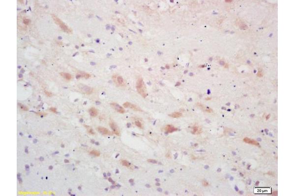 PSCA antibody  (AA 24-123)