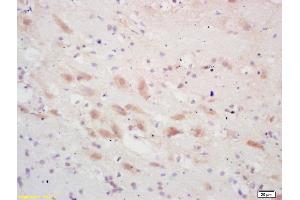 Formalin-fixed and paraffin embedded rat brain labeled with Rabbit Anti PSCA Polyclonal Antibody, Unconjugated (ABIN671676) at 1:200 followed by conjugation to the secondary antibody and DAB staining (PSCA antibody  (AA 24-123))
