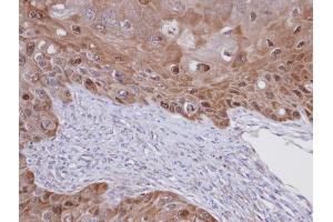 IHC-P Image Immunohistochemical analysis of paraffin-embedded SCC15 xenograft, using IDI1 , antibody at 1:100 dilution. (IDI1 antibody)