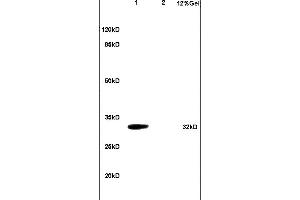 L1 mouse brain lysates L2 mouse heart lysates probed with Anti TNFRSF13B Polyclonal Antibody, Unconjugated (ABIN680488) at 1:200 in 4 °C. (TACI antibody  (AA 21-120))