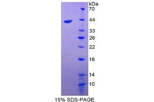 SDS-PAGE (SDS) image for Villin 1 (VIL1) (AA 1-320) protein (His tag) (ABIN2127227) (Villin 1 Protein (VIL1) (AA 1-320) (His tag))
