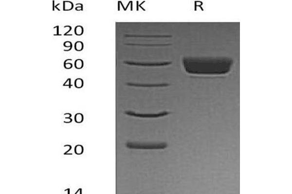 SERPINA3N Protein (His tag)