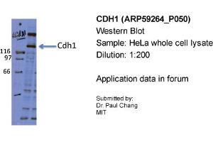 Sample Type: HeLa whole cell lysatePrimary Dilution: 1:200 (E-cadherin antibody  (Middle Region))