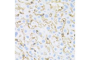 Immunohistochemistry of paraffin-embedded mouse liver using INSR antibody (ABIN5970115) at dilution of 1/100 (40x lens). (Insulin Receptor antibody)