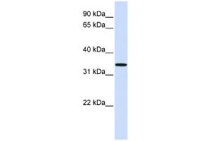 WB Suggested Anti-C16orf78 Antibody Titration: 0. (C16orf78 antibody  (Middle Region))