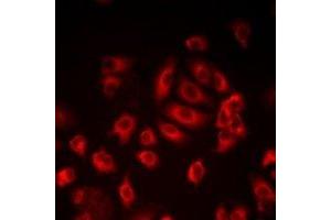 Immunofluorescent analysis of LITAF staining in HepG2 cells. (LITAF antibody)