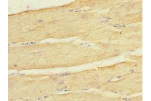 Immunohistochemistry of paraffin-embedded human skeletal muscle tissue using ABIN7157020 at dilution of 1:100 (KCNJ4 antibody  (AA 316-445))