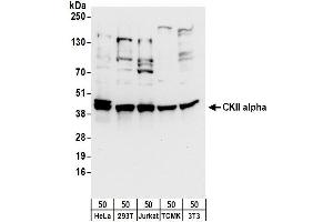 Western Blotting (WB) image for anti-Casein Kinase 2 alpha 1 (CSNK2A1) (C-Term) antibody (ABIN7453947)