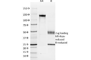 SDS-PAGE Analysis Purified KSP-Cadherin Mouse Monoclonal Antibody (SPM594).