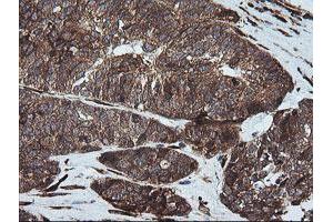 Immunohistochemistry (IHC) image for anti-Formiminotransferase Cyclodeaminase (FTCD) antibody (ABIN1496380) (FTCD antibody)